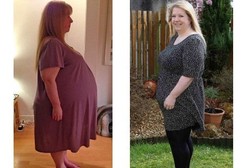 Perut Buncit Dikira Hamil, Ternyata Ada Kista 31 Kg di Ovarium Lorna