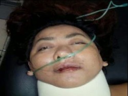 Penculik Bayi di RSHS Alami Patah Tulang Usai Loncat dari Jembatan