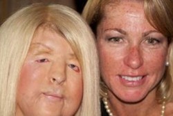 Caitlin Sarubbi, Penyandang Disabilitas yang Berlaga di Paralympic Games