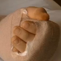 Charger Meledak, Pengguna iPhone Terkapar