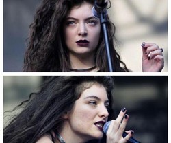 Lorde Kesal Wajahnya yang Berjerawat Diedit Jadi Mulus