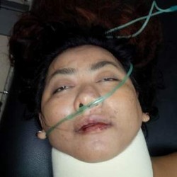 Kondisi Desi Ariani Berangsur Stabil