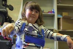 Berkat Lengan Robotik, Akhirnya Gadis Cilik Ini Bisa Mengangkat Tangannya