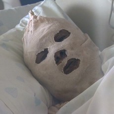 Tak Dapat Bantuan Pangan, Wanita Pengungsi Suriah Nekat Bakar Diri