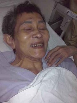 Kasihan, Ibu Ini 7 Bulan di RSHS Tak Ada Keluarga yang Menjenguk