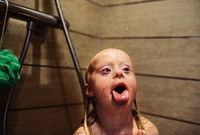 Foto-foto Menggemaskan Emmy, Bocah dengan Down Syndrome di Denmark