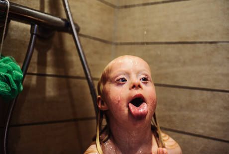 Foto-foto Menggemaskan Emmy, Bocah dengan Down Syndrome di Denmark
