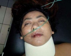 Desi Sudah Bisa Bicara, Apa Alasan Dia Menculik Bayi di RSHS?