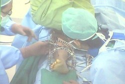 Sistem Komputerisasi Ini Ini Bisa Luruskan Kaki Berbentuk O