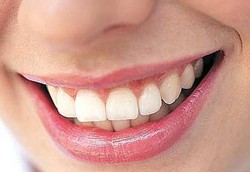 Kenali, Ini Berbagai Penyebab Warna Gigi Bisa Berubah