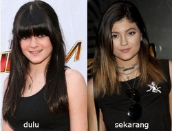 Baru Berusia 16 Tahun, Adik Kim Kardashian Digosipkan Suntik Botoks