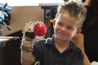 Robohand, Lengan Robotik Murah Hasil Karya Tukang Kayu