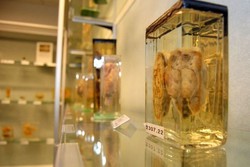 Hii..! Seramnya Museum Penyakit di Australia