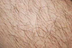 Ini Penjelasan Mengapa Rambut Kepala, Lengan, dan Kemaluan, Berbeda