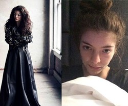 Lorde Kecewa Hidungnya Diedit Jadi Lebih Mancung di Majalah