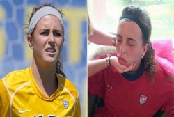 Caitlin McComish, Pemain Sepakbola yang Alergi Keringatnya Sendiri