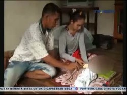 Malang! Bayi Lahir dengan Otak di Luar Kepala