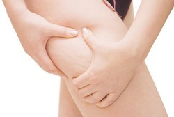 Kulit Kemerahan, Bengkak, Nyeri, dan Terasa Hangat? Waspadai Selulitis