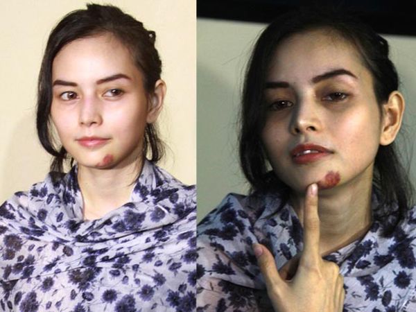 DJ Verny Pamer Luka Akibat Dianiaya Suami Siri