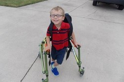 6 Anak yang Pantang Menyerah Meski Idap Penyakit Langka