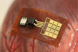 Canggih! Alat Pembunuh Bakteri Ini Bisa Luruh Diserap Tubuh