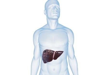 76+ Gambar Organ Hati Yang Rusak Paling Hist