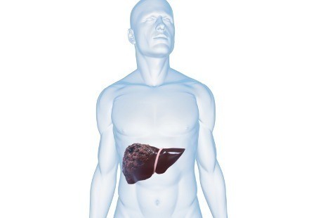 76+ Gambar Organ Hati Yang Rusak Paling Hist 76+ Gambar Organ Hati Yang Rusak Paling Hist