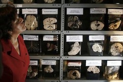 Hii... Museum di Peru Ini Isinya 3.000 Otak Manusia