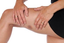 Mendadak Ada Memar di Tangan dan Paha, Benarkah karena Dijilat Setan?