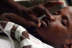 Dalam Hitungan Jam, Dehidrasi Akibat Kolera Bisa Sebabkan Kematian