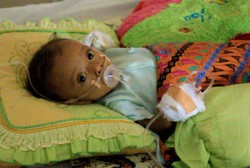 Setelah Bobotnya Cukup, Bayi dengan Kelainan Hati di Aceh Ini Dibawa ke RSCM