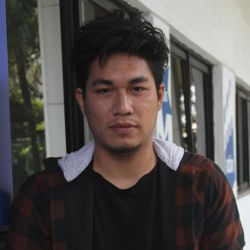 Cedera Lutut, Rizal Armada Manggung Gunakan Tongkat