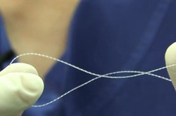 Orang Yang Dilarang Melakukan Perawatan Tanam Benang