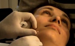 Dos & Donts Saat Ingin Melakukan Tanam Benang di Tubuh untuk Kecantikan