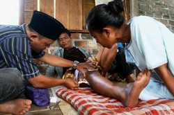 Pria ini Selamat dari Maut Setelah Bertarung Hebat dengan Buaya Muara