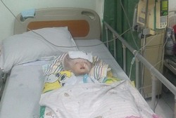 Kisah Petra, Bocah Pengidap Hidrosefalus Asal Pontianak