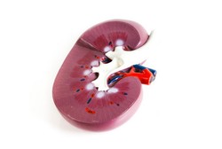 Ginjal pun Perlu Airbag dan Sabuk Pengaman untuk Cegah Benturan