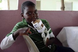 Bocah Ini Dapat Tangan Prostetik dari Printer 3D Pertama di Haiti