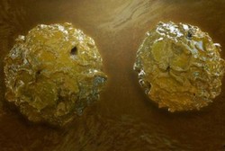 Orang Gemuk Berisiko Nyeri Tulang Jika Jadi Donor Stem Cell, Benarkah?