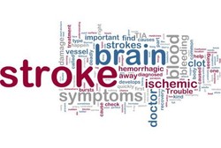 Hindari 3G, Jurus Jitu Cegah Penyakit Stroke