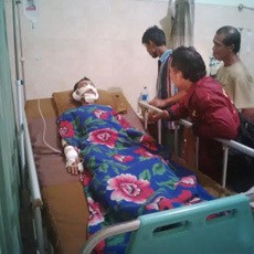 Tiga Pekerja Terluka Bakar akan Dirujuk ke Rumah Sakit di Surabaya