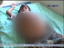 Tak Miliki Uang untuk Operasi, Balita Tanpa Anus Terlantar