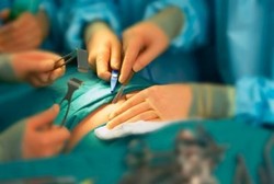 Perhatikan, Seperti Ini Metode Operasi Usus Buntu dan Proses Pemulihannya