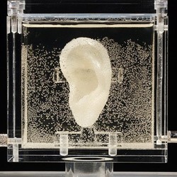 Replika Telinga Hidup Vincent van Gogh Dipamerkan