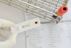 Pernah DBD Belum Tentu Bikin Kebal, Kali Kedua Justru Lebih Berbahaya