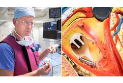 Alat Pacu Jantung Terkecil di Dunia Berhasil Ditanam di Tubuh Pasien