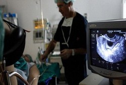 Kondisi Begini Membuat Wanita Harus Melakukan USG Transvaginal