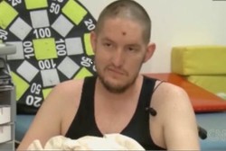 Dipukuli Hingga Kepala Cedera Parah, Pria Ini Ketahuan Idap Tumor Otak