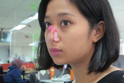 Dijepit Biar Mancung, Hati-hati Hidung Bisa Bengkok
