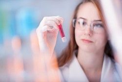 Identifikasi Serangan Stroke Lewat Cek Kekentalan Darah